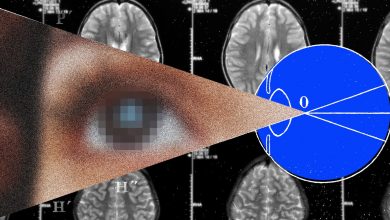 The Next Frontier for Brain Implants Is Artificial Vision