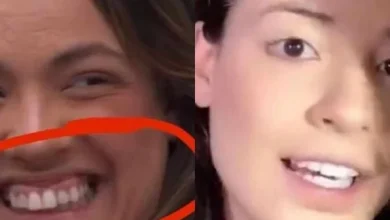 Ana Paula Renault acusa Beatriz de retirar lentes dos dentes para criar personagem