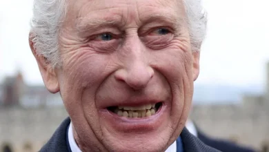 Entenda porque Rei Charles III está com sorriso amarelo e torto