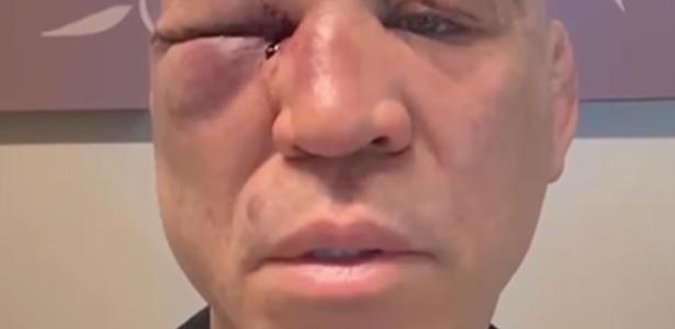 Wanderlei comenta briga com Popó: “Fui agredido covardemente”