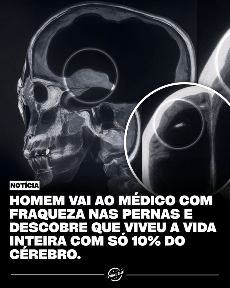 Em 2007, médicos franceses lidaram com um caso surpreendente mundialmente.